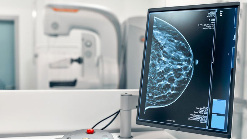 Mammography Centre
